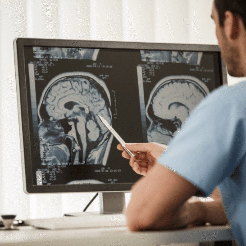 Physician examining medical image of brain on desktop computer