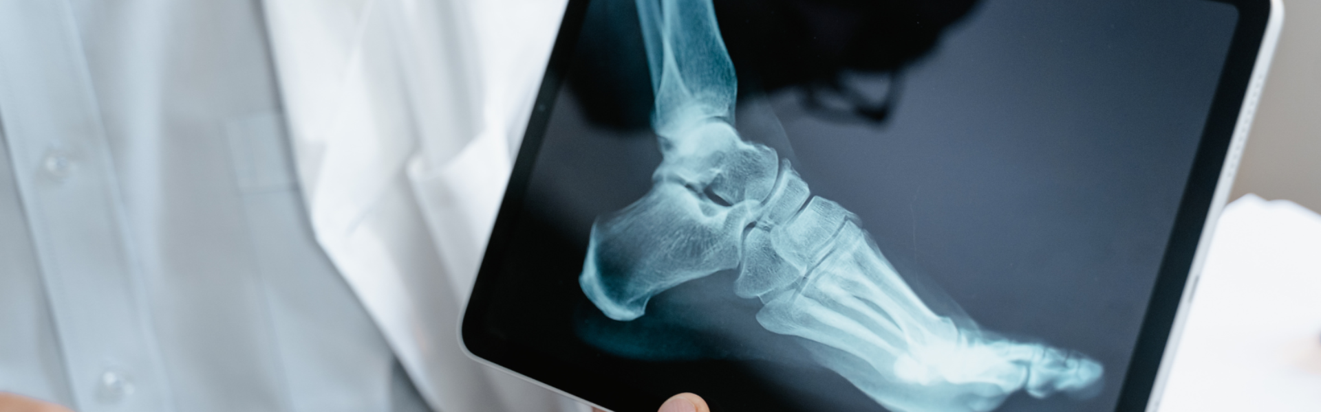 Foot xray on tablet computer